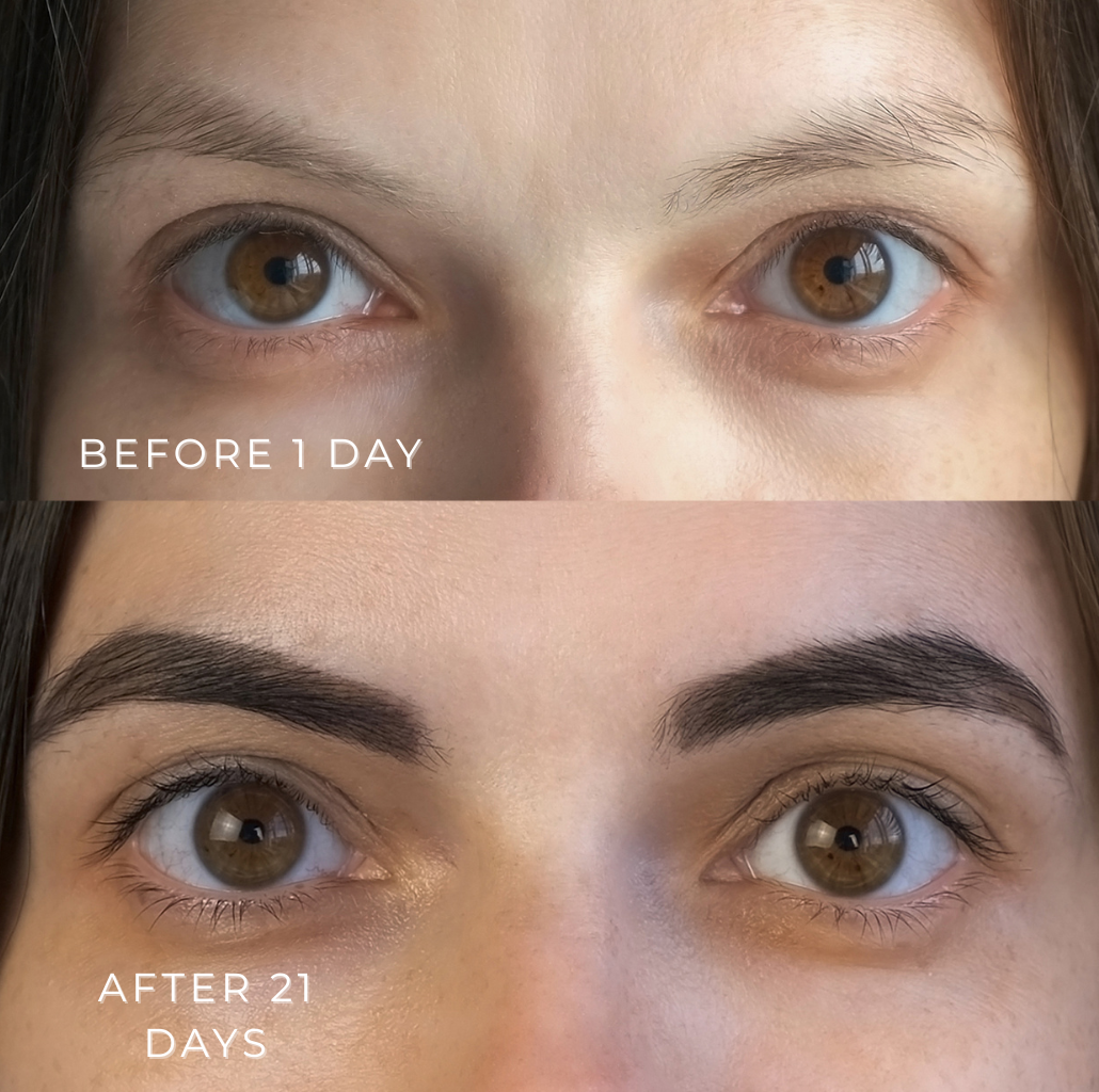 Eyebrow Growth Serum