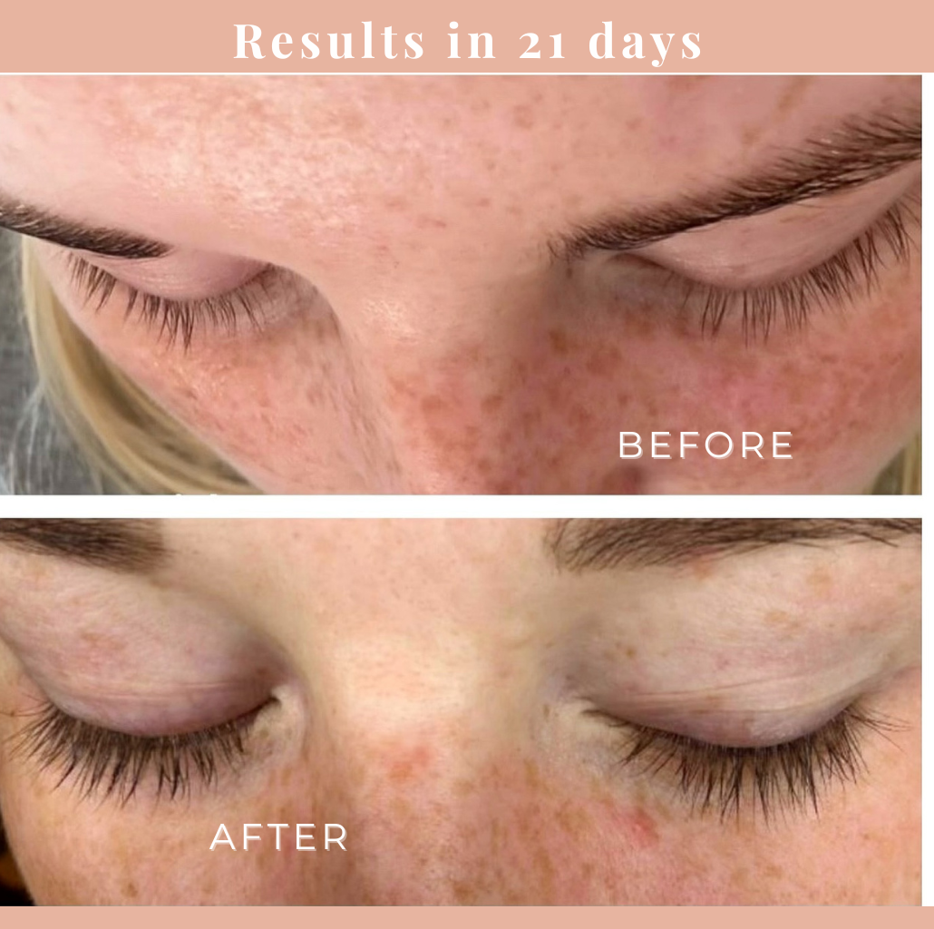 Eyelash Growth Serum.